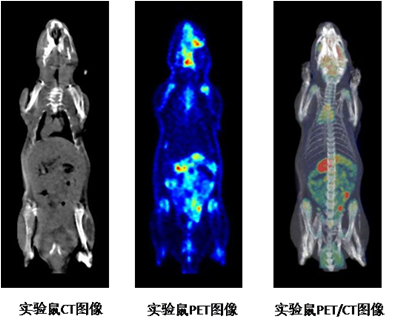 PET-CT成像